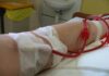 Ανάγκη για αίμα: Η νεαρή Άρτεμις μας χρειάζεται