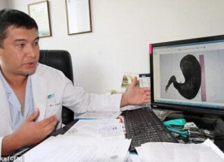 Δείτε τι βρήκαν μέσα σε μια 18χρονη κοπέλα – Παραλίγο να πεθάνει