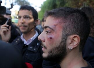 Ο φοιτητής που χτυπήθηκε στη Νομική στην πορεία για το Πολυτεχνείο (φωτο)