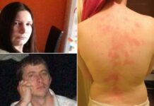 Δε θα πιστεύετε σε τι είναι αλλεργική αυτή η κοπέλα!