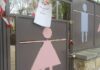 Κρίσιμες ώρες για το αγοράκι που ακρωτηριάστηκε σε παιδική χαρά