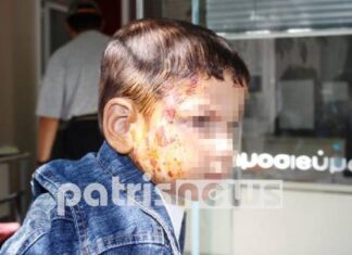 ΚΑΤΑΓΓΕΛΙΑ – ΣΟΚ: Εργοδότης έλουσε με καυτό καφέ αγοράκι 2 ετών!