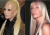11 celebrities που έχασαν το μέτρο με τις πλαστικές (ΦΩΤΟ)