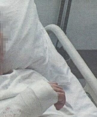 Θύμα άγριου ξυλοδαρμού γνωστός Έλληνας τραγουδιστής – Σοκαρισμένη η κόρη του !