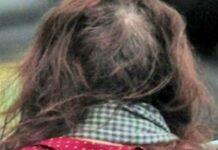 Σοκαριστικό! Δεν φαντάζεστε ποια διάσημη ηθοποιός είναι η κυρία στην φωτογραφία!
