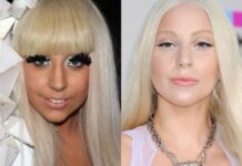 10 celebrities και ο… Πούτιν πριν και μετά τον πλαστικό (Φωτο)