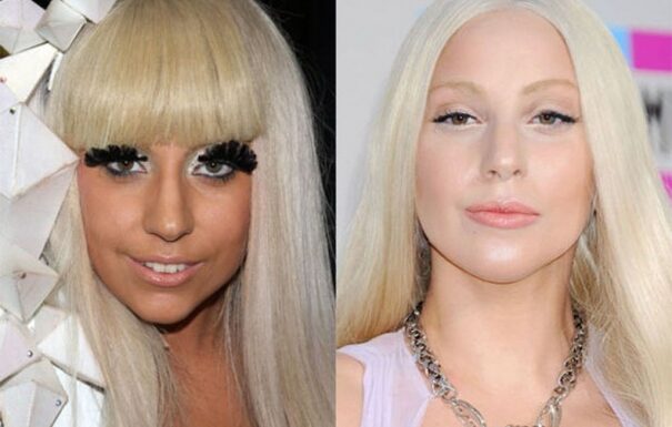 10 celebrities και ο… Πούτιν πριν και μετά τον πλαστικό (Φωτο)