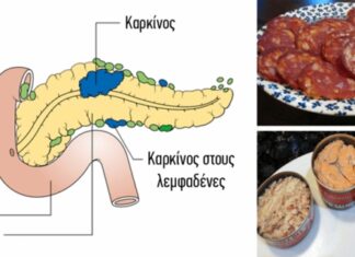 3 ΤΡΟΦΕΣ που έχουν αποδειχθεί ότι προκαλούν ΚΑΡΚΙΝΟ – Δεν πρέπει να τις ξαναβάλετε στο στόμα σας…
