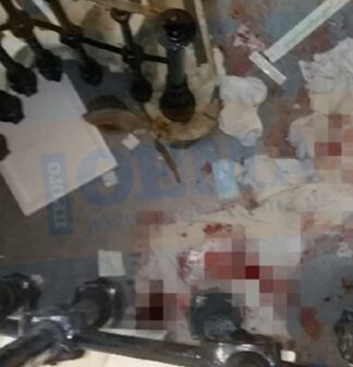 ΑΙΣΙΟΔΟΞΑ ΝΕΑ για τον 26χρονο γιατρό που τραυματίστηκε στο νοσοκομείο «Ελπίς»