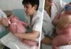 ΑΠΙΣΤΕΥΤΟ: Μωρό γεννήθηκε 18 κιλά και είναι το μεγαλύτερο σε όλο το κόσμο