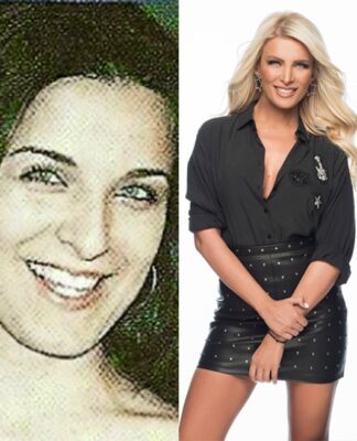7+1 Ελληνίδες celebrities πριν και μετά την πλαστική μύτης