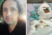 Του ζήτησε να χωρίσουν και την πυρπόλησε από ζήλεια