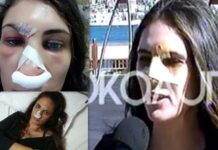 Η συγκλονιστική μαρτυρία της Ναστάζια Μητροπούλου που βρέθηκε λιπόθυμη σε «λίμνη» αίματος