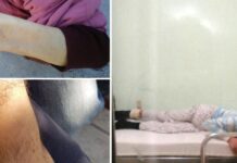 Τραγική εξέλιξη: Απεβίωσε ένα από τα άτομα με αυτισμό που έδεναν στο Λοιμωδών