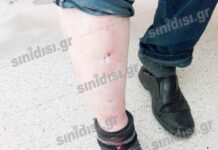 Αγρίνιο: Μαρτύριο στα χέρια ληστών – Σακάτεψαν τα δύο αδέρφια στο ξύλο – Σκληρές εικόνες μετά τα βασανιστήρια