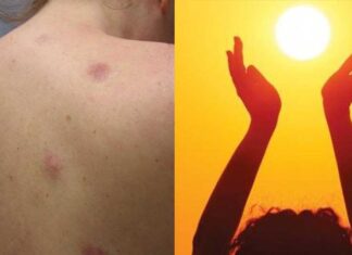 Επτά στους 10 Έλληνες με έλλειψη βιταμίνης D: Πώς θα γεμίσετε τις μπαταρίες