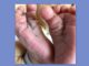 It’s a boy! Μόλις έγινε μπαμπάς και πόσταρε την πρώτη φωτό στο instagram