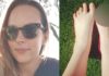 29χρονη πήγε σε spa ψαριών και μετά της ακρωτηρίασαν και τα 5 δάκτυλα των ποδιών της