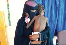 Συγκλονιστικές φωτογραφίες δείχνουν πώς είναι να πεθαίνεις από την πείνα