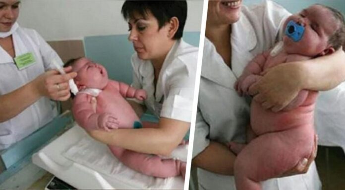 Μωρό γεννήθηκε 18 κιλά και είναι το μεγαλύτερο σε όλο το κόσμο! Δεν θα πιστεύετε όμως πόσο ζυγίζει η μαμά του