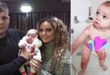 Μωρό λίγο έλειψε να χάσει τη ζωή του όταν ένας συγγενής το φίλησε και του κόλλησε τον ιό του έρπη