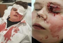 Νταήδες «σάπισαν στο ξύλο» 15χρονο μαθητή και του έσπασαν τα γυαλιά στο πρόσωπο για να σπάσουν πλάκα