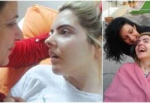 Μετά από 4 χρόνια στο κρεβάτι η Ασπασία στέκεται ξανά μόνη της