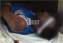 Πάτρα: Ξυλοκόπησαν κρατούμενο μέχρι θανάτου – Εικόνες σοκ