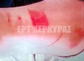 Κέρκυρα: Έζησε την κόλαση σε κουζίνα γνωστού εστιατορίου – Καταγγελία σπουδαστή μαγειρικής για «μεσαιωνικά» βασανιστήρια.