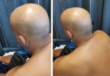 «Τρεις ώρες κυκλοφορούσα με το μαχαίρι καρφωμένο στον λαιμό μου»
