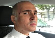 Μπογδάνος: Ατύχημα στη βροχή – Η φωτογραφία με το ματωμένο πουκάμισο