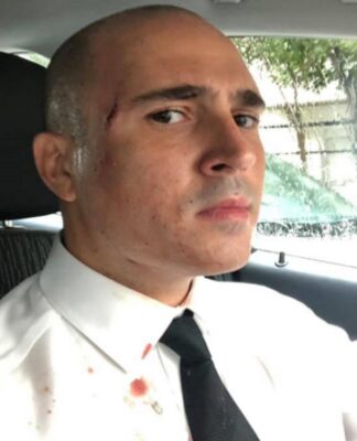 Μπογδάνος: Ατύχημα στη βροχή – Η φωτογραφία με το ματωμένο πουκάμισο