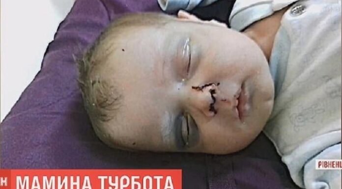 ΣΟΚ: Μητέρα έσπασε στο ξύλο το ενός μηνός μωρό της! Δίνει μάχη για τη ζωή του (ΦΩΤΟ)