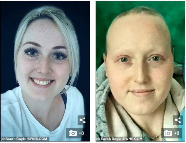 Της είπαν πως έχει καρκίνο και της έκοψαν τους 2 μαστούς. Μήνες μετά τις είπαν πως έκαναν λάθος διάγνωση - Εικόνα 3