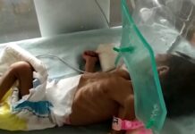 Φρίκη στην Ινδία. Βρέθηκε θαμμένο ζωντανό νεογέννητο κοριτσάκι