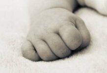 Βρέφος γεννήθηκε με τρία πόδια και δύο ουρήθρες (ΦΩΤΟ)