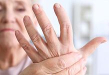 ΡΕΥΜΑΤΟΕΙΔΗΣ ΑΡΘΡΙΤΙΔΑ: 5 ανησυχητικά σημάδια ότι οι αρθρώσεις σας νοσούν