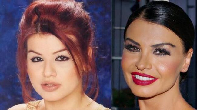 11 διάσημες Ελληνίδες πριν και μετά την πλαστική μύτης - Εικόνα 14