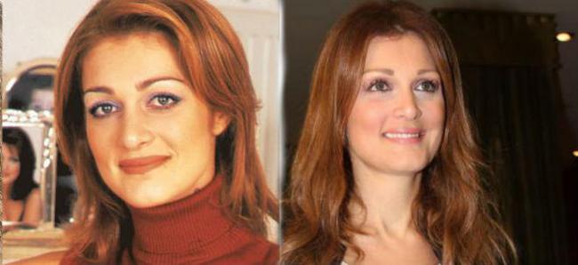 11 διάσημες Ελληνίδες πριν και μετά την πλαστική μύτης - Εικόνα 15