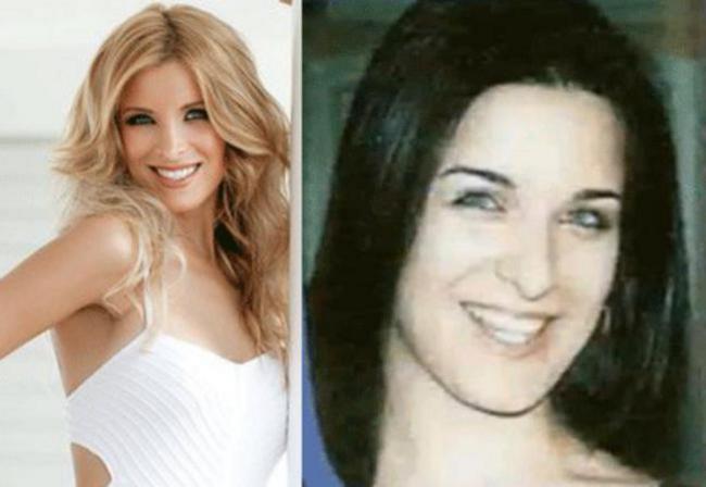 11 διάσημες Ελληνίδες πριν και μετά την πλαστική μύτης - Εικόνα 5