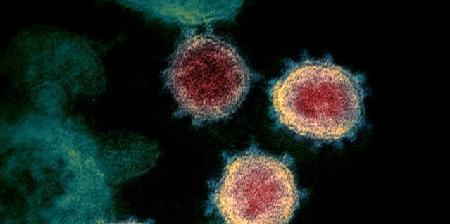 Transmission electron microscope image shows SARS-CoV-2, also known as novel coronavirus