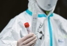 ΠΟΥ για υδροξυχλωροκίνη: Σε 24 ώρες θα αποφασίσουμε αν θα διακόψουμε τις δοκιμές
