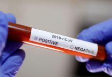 ΚΕΡΚΥΡΑ: Θετική 35χρονη έγκυος – 17 τα κρούσματα στο νησί