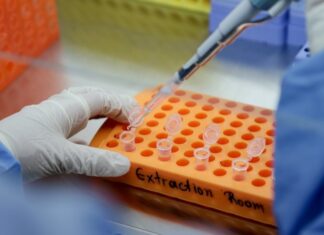 ΝΕΑ ΜΕΛΕΤΗ: Η υδροξυχλωροκίνη «μακροπρόθεσμα» δεν προστατεύει από σοβαρές επιπτώσεις του Covid-19