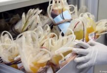 ΚΟΡΩΝΟΪΟΣ: Όλη η αλήθεια για τη θεραπεία πλάσματος