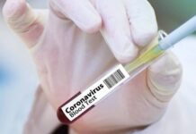 Κορονοϊός – Αναστολή δοκιμών εμβολίου AstraZeneca: Ο Νίκος Σύψας εξηγεί τι συνέβη