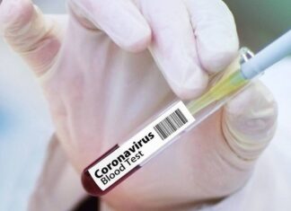 Κορονοϊός – Αναστολή δοκιμών εμβολίου AstraZeneca: Ο Νίκος Σύψας εξηγεί τι συνέβη