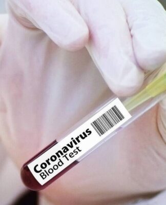 Κορονοϊός – Αναστολή δοκιμών εμβολίου AstraZeneca: Ο Νίκος Σύψας εξηγεί τι συνέβη