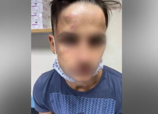 Επίθεση σε 17χρονο στο Γαλάτσι: Η συμμορία είχε χτυπήσει και 16χρονο στα Πατήσια