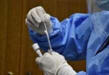 ΚΟΡΩΝΟΪΟΣ – ΑΔΕΙΑ: Πόσο μπορείτε να λείψετε για να κάνετε δωρεάν έλεγχο Covid-19